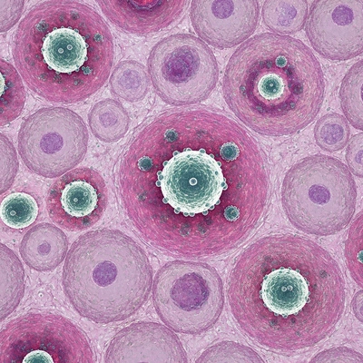 Microscopic view of mumps virus infecting testicular cells, highly detailed, medical illustration